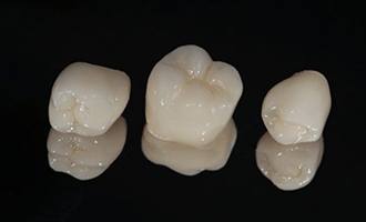 Three separate teeth without crowns