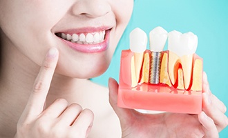 woman pointing to her smile while holding model for dental implants