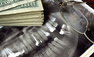 X-ray and money representing the cost of dental implants
