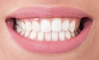 Healthy gums and teeth