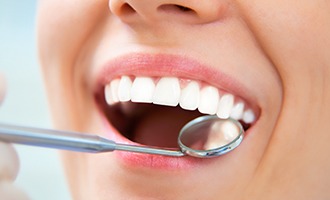 Closeup of smile during dental treatment