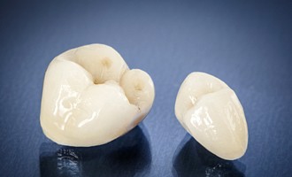 Two white dental crowns on a black background