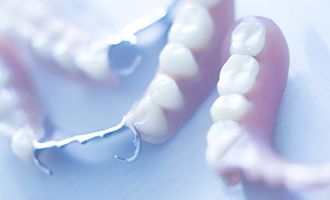 Partial dentures before placement