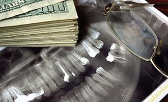 X-ray and money representing the cost of dental implants