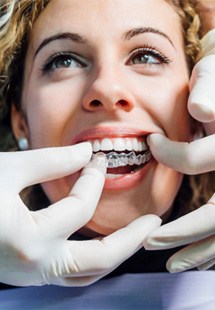 woman getting Invisalign 