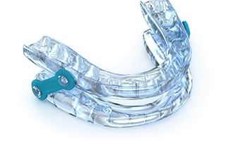 A digital image of an oral appliance