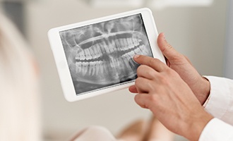 Dental x-rays on tablet computer