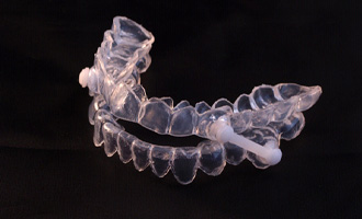 An oral appliance in Westminster