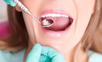 Closeup of smile during dental exam