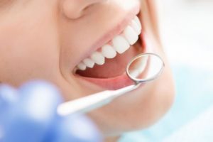 A smiling woman getting a dental exam