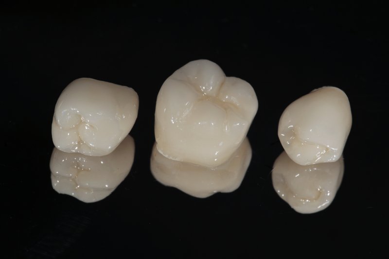 Dental Crowns