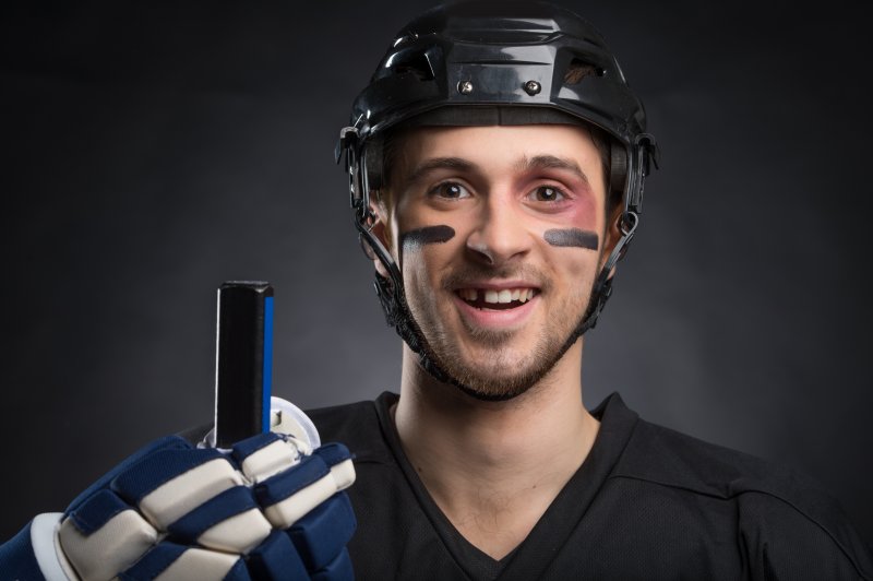 a male hockey player with his mouth open and showing off his knocked-out tooth