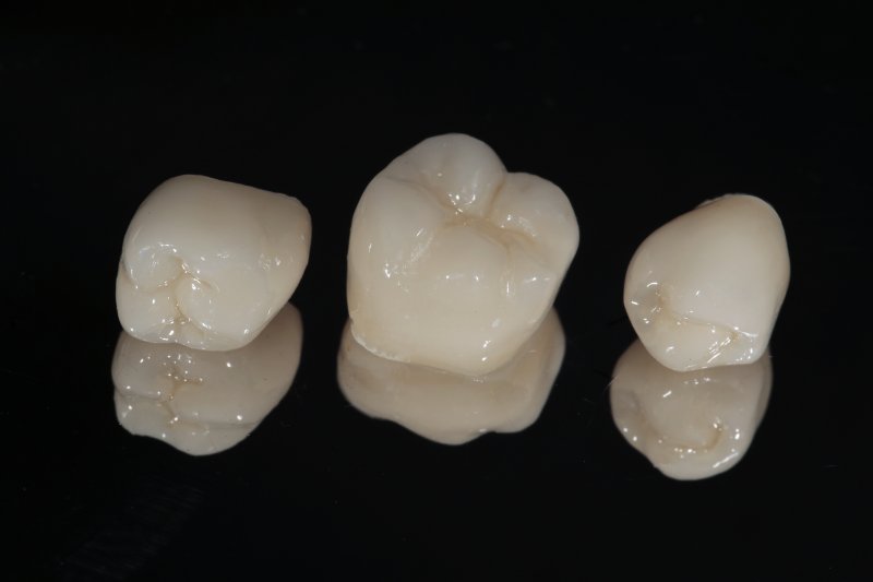dental crowns in Westminster