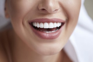 woman with straighter smile