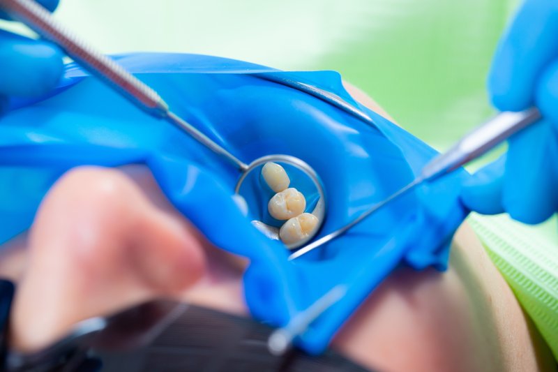 person undergoing a root canal